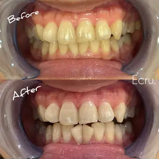 メンズ キッズ ホワイトニングサロン Ecru所属・ホワイトニングサロン Ecru エクリュのその他イメージ