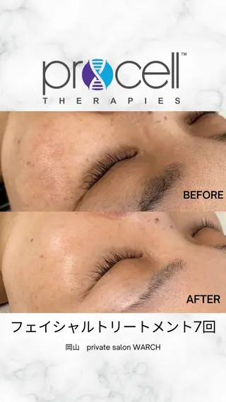 WARCH Marieのその他イメージ