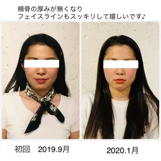 ロング ヘアアレンジ 小顔矯正専門サロンジュマリ所属・町田 淳子のエステ・リラクイメージ