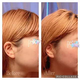 デトックス美容専門サロンpeony所属・デトックス美容専門 サロンpeonyのエステ・リラクイメージ