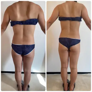 FLEUR大阪・整体 ・ハイフ・痩身・小顔のエステ・リラクイメージ