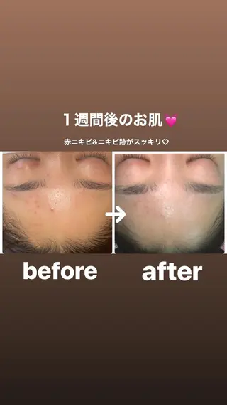 FLEUR大阪・整体 ・ハイフ・痩身・小顔のエステ・リラクイメージ