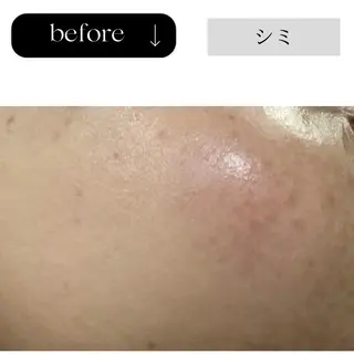 beauty CHOOSEのマツエク・マツパデザイン