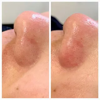 メンズ MISEREL岡崎店 Ayaのエステ・リラクイメージ