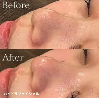 【京都市最安値】 salon YMのエステ・リラクイメージ