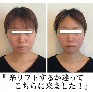 La　Beaute Verite所属・浅居 結菜のその他イメージ