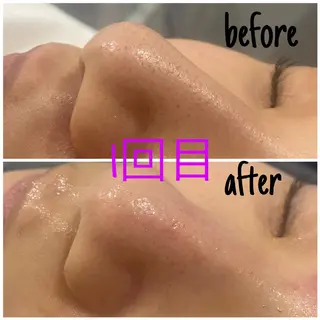 毛穴洗浄・痩身・脱毛 /アルカンジュのエステ・リラクイメージ