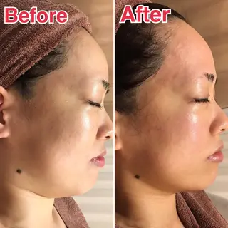 🗻エステティック RAYVIS藤🐈のエステ・リラクイメージ