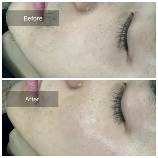 メンズ トータルしみケア専門 NICA(ニカ)のエステ・リラクイメージ