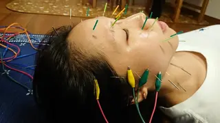 鍼灸サロンKEYAKI所属・美容鍼灸師 皆吉 秀樹のエステ・リラクイメージ