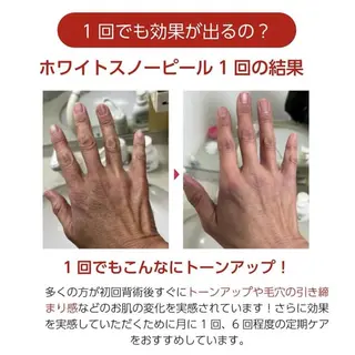 RinRin 山口店のエステ・リラクイメージ