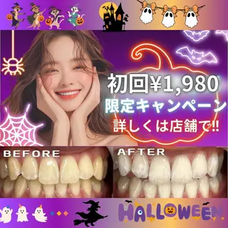 LBSホワイトニング 🌐岡山店のその他イメージ