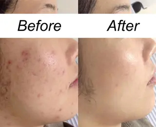 ミディアム カラー パーマ ヘアアレンジ メンズ キッズ ネイル マツエク・マツパ 都度払い肌質改善 &脱毛Blancheのエステ・リラクイメージ