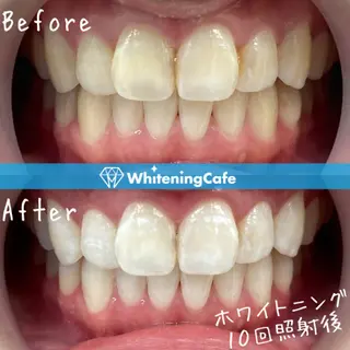 ホワイトニングカフェ神戸元町店所属・ホワイトニングカフェ 神戸元町店のエステ・リラクイメージ