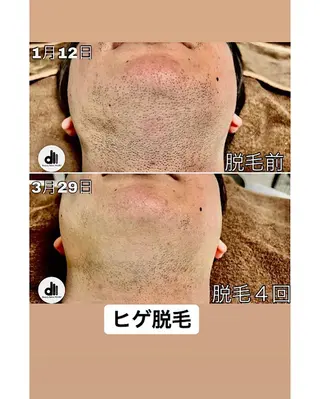 メンズ Beauty Salon MARU所属・新潟市メンズ【脱毛】 MARUのエステ・リラクイメージ