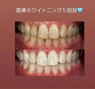 Kaula所属・Kaula セルフホワイトニングのその他イメージ