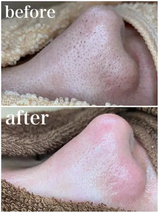 韓国肌管理 【毛穴専科】のエステ・リラクイメージ