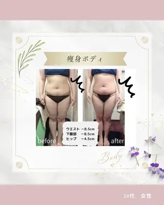 痩身専門エステ addissimoのエステ・リラクイメージ