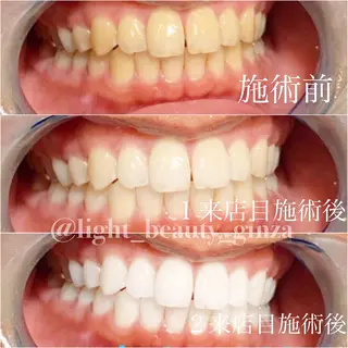 ライトビューティー 銀座本店のエステ・リラクイメージ