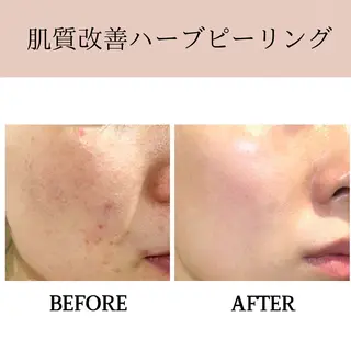 肌質改善専門サロン Bellmi/心斎橋のエステ・リラクイメージ