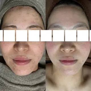 beauty salon　REBORN所属・REBORN所属 小山のエステ・リラクイメージ
