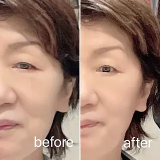 痛くないシミ取り 【荻窪】石橋のヘアスタイル