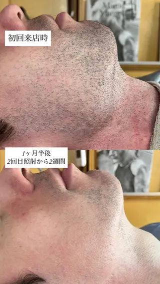 little  galleria所属・岡田 杏のエステ・リラクイメージ