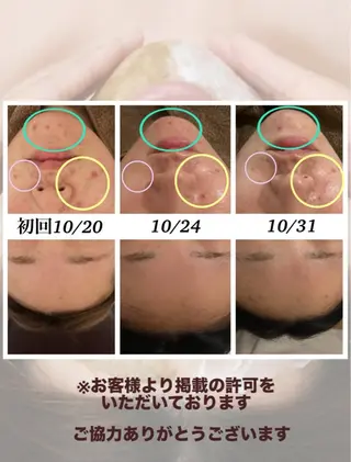 ベルーテ エッセンスのエステ・リラクイメージ