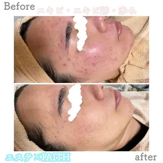 ショート カラー パーマ ヘアアレンジ メンズ キッズ ネイル マツエク・マツパ アイブロウ ニキビ&跡改善サロン オーナー光木のエステ・リラクイメージ