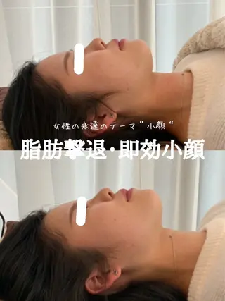 最速小顔・肌質管理 ❣️エスポワールのエステ・リラクイメージ