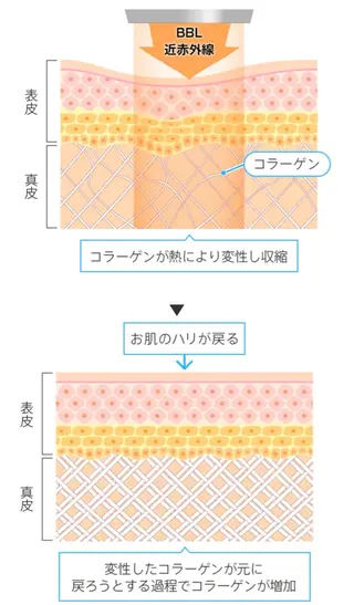 メンズ 脱毛サロン BRIDGE橋本のエステ・リラクイメージ