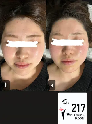 217whitening  room所属・217 ホワイトニングルームのエステ・リラクイメージ