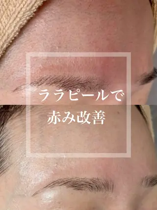 WHITE AQUA 北千住店のエステ・リラクイメージ