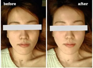 佐々木 唯のエステ・リラクイメージ