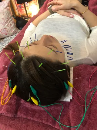 美容鍼灸女性専用 りんご鍼灸治療院のその他イメージ