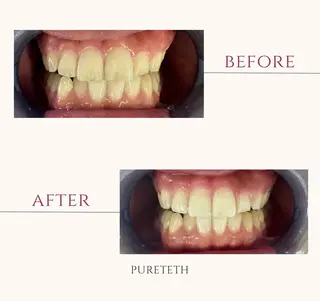 メンズ ホワイトニングサロンPURETETH所属・ホワイトニングサロン PURETETHのエステ・リラクイメージ
