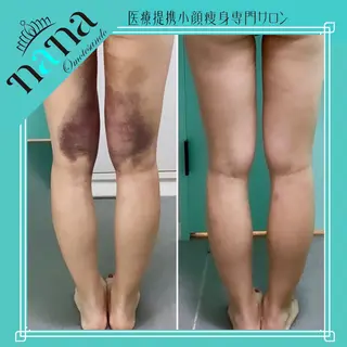 小顔痩身インディバ Nana表参道のエステ・リラクイメージ