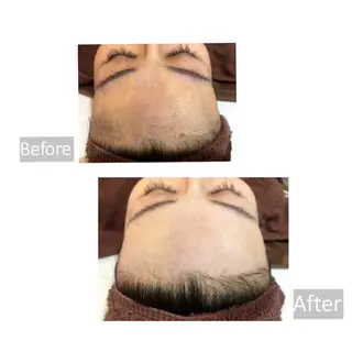 美肌脱毛i所属・美肌脱毛i |泉大津のエステ・リラクイメージ