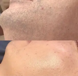 yokohama 🎀miaのマツエク・マツパデザイン