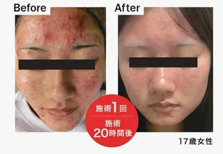 脂肪冷却/エステ COCOKARAのエステ・リラクイメージ