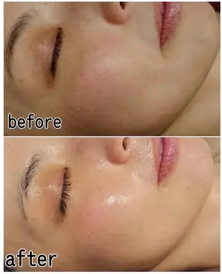 private salon Rions所属・育乳/整体/痩身 サロンRIONSのエステ・リラクイメージ