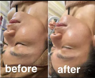 美容鍼灸サロン mahoroba院長のエステ・リラクイメージ