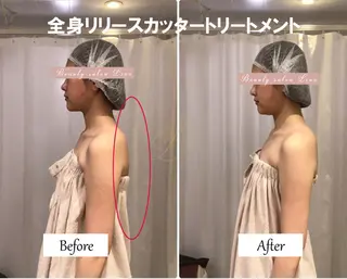 痩身×フェイシャル ブライダル|Linoのエステ・リラクイメージ