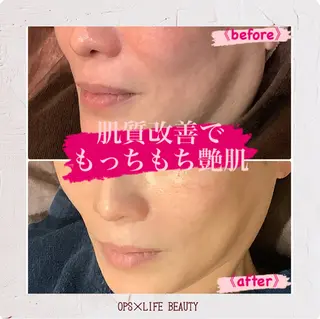 メンズ OPS×LIFE BEAUTY所属・OPS×LIFE BEAUTY/maiのエステ・リラクイメージ