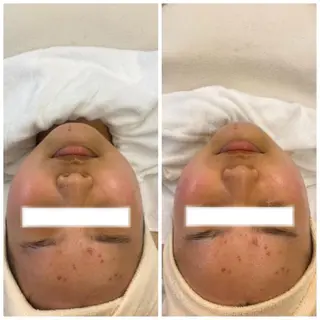 ネイル マツエク・マツパ アイブロウ 肌質改善美容サロン ému 用賀のエステ・リラクイメージ