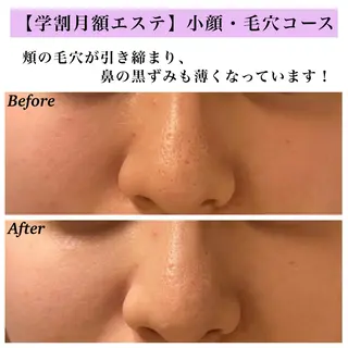 Bellesthe (ベルエステ)のエステ・リラクイメージ