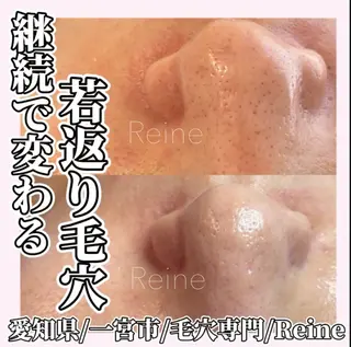 Reine BeautySalon所属・毛穴/シミ肝斑/脱毛 横山梨里のエステ・リラクイメージ