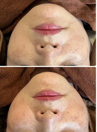 ■超絶小顔&肌管理室■所属・🦋整形級の究極美顔 本格韓国式小顔🦋のエステ・リラクイメージ