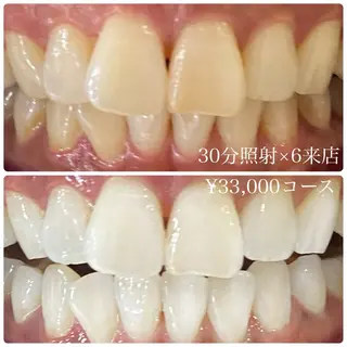 メンズ ホワイトニングルーム 川崎店所属・ホワイトニング ルーム 川崎店のその他イメージ