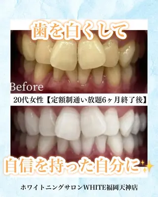 メンズ キッズ ホワイトニング専門店 WHITE天神店のエステ・リラクイメージ